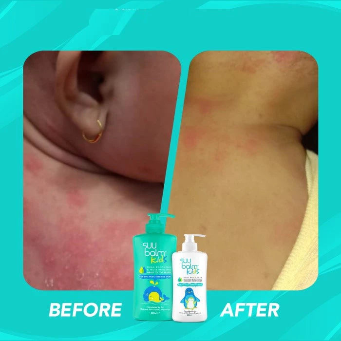 Suu Balm Kids Lotion / Lotion Bayi & Anak 75ml