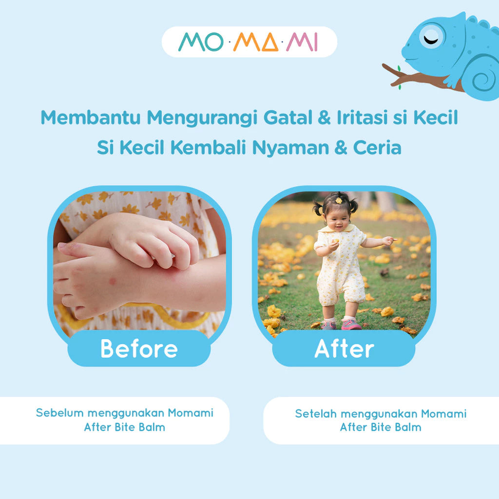 Momami After Bite Balm 14gr - Balsem stik pereda gatal alami gigitan serangga, aman untuk anak
