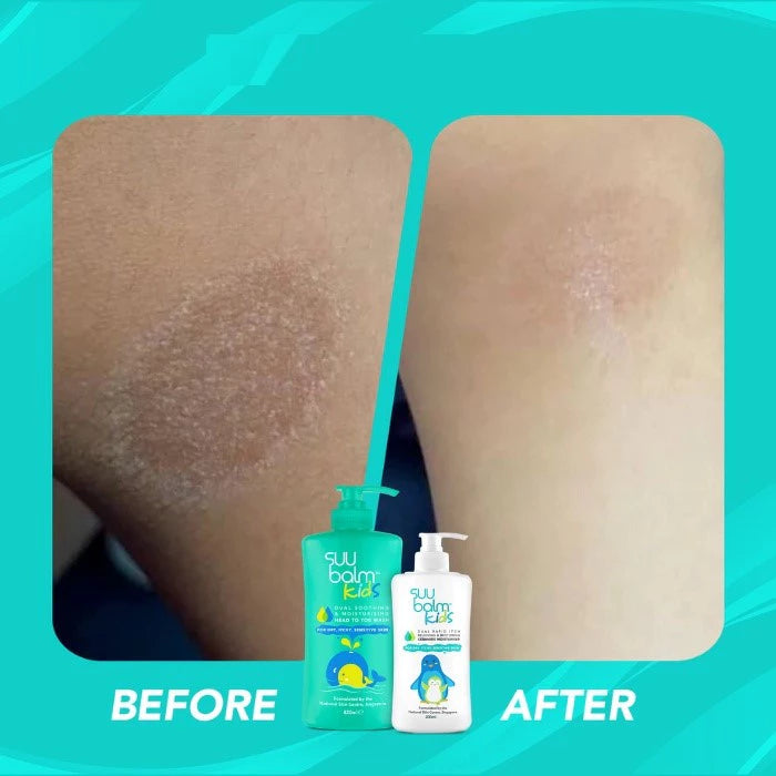 Suu Balm Kids Lotion / Lotion Bayi & Anak 75ml