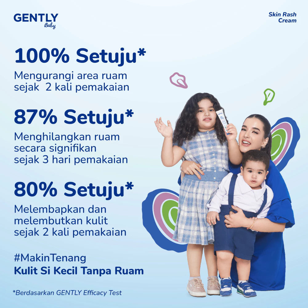 Gently Baby Rash Cream 50 gr / Krim Pereda Ruam Popok pada Bayi