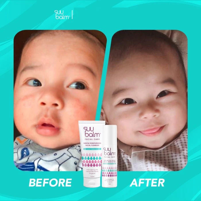 Suu Balm Gentle Moisturising Facial Cleanser for Dry Itchy Sensitive Problem Skin 100ml