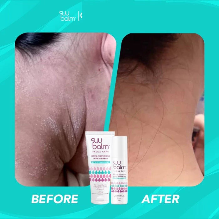 Suu Balm Gentle Moisturising Facial Cleanser for Dry Itchy Sensitive Problem Skin 100ml
