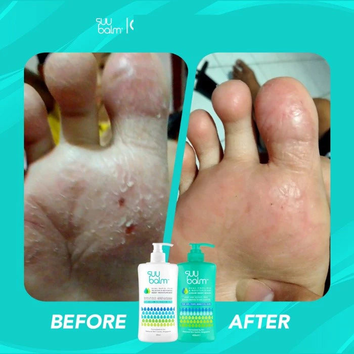 Suu Balm Adult Body Wash / Sabun Mandi dewasa (100ml)