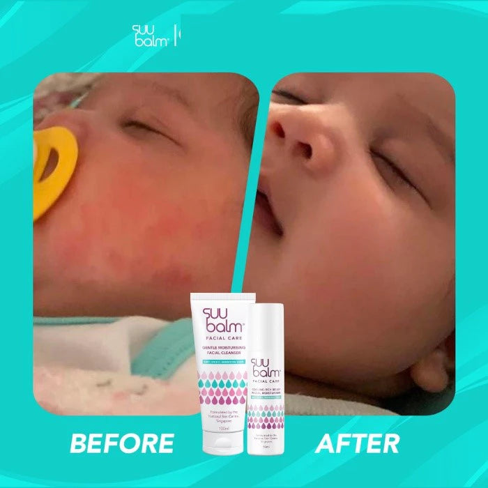 Suu Balm Gentle Moisturising Facial Cleanser for Dry Itchy Sensitive Problem Skin 100ml