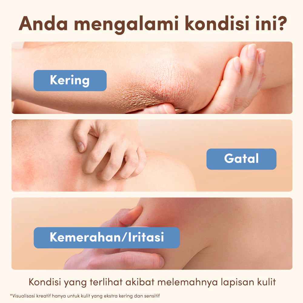 AVEENO Dermexa Daily Emollient Cream 200g-Lotion Pelembap untuk Kulit Sensitif, Kering & Rawan Eksim