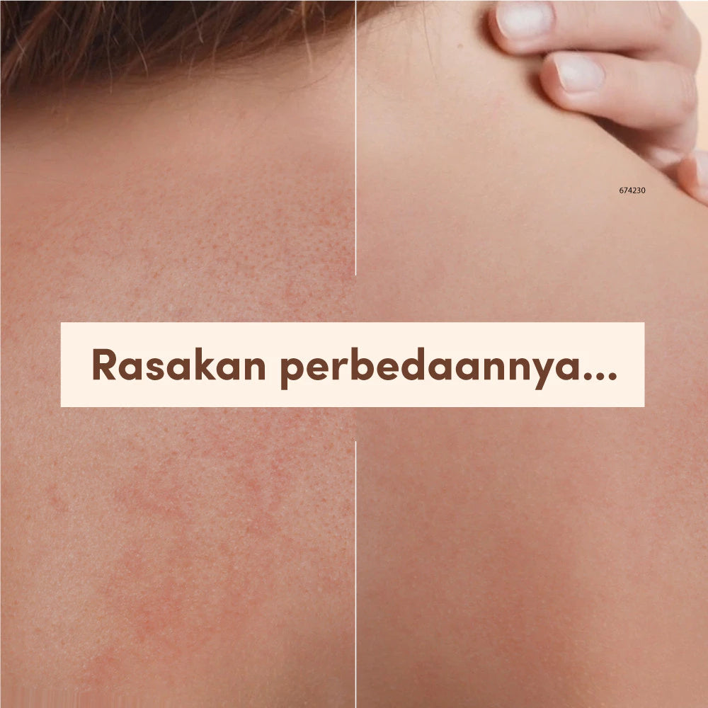 AVEENO Dermexa Daily Emollient Cream 200g-Lotion Pelembap untuk Kulit Sensitif, Kering & Rawan Eksim