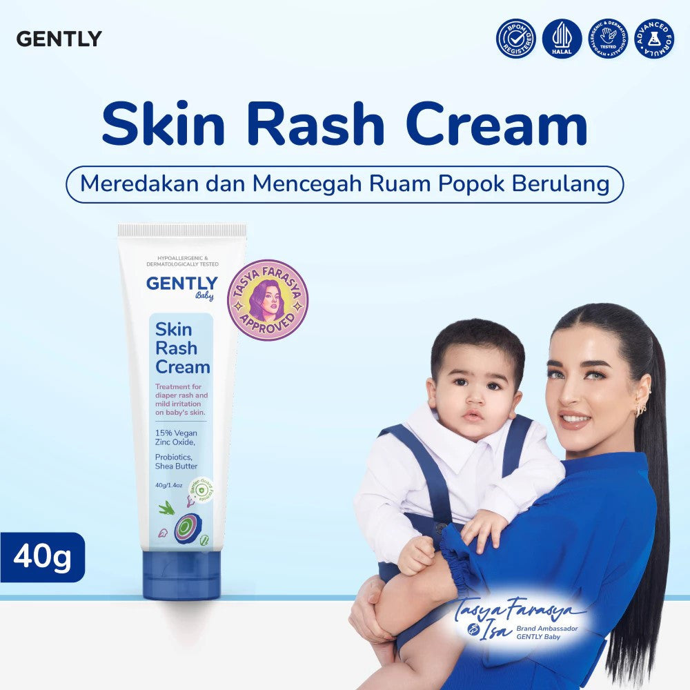 Gently Baby Rash Cream 50 gr / Krim Pereda Ruam Popok pada Bayi